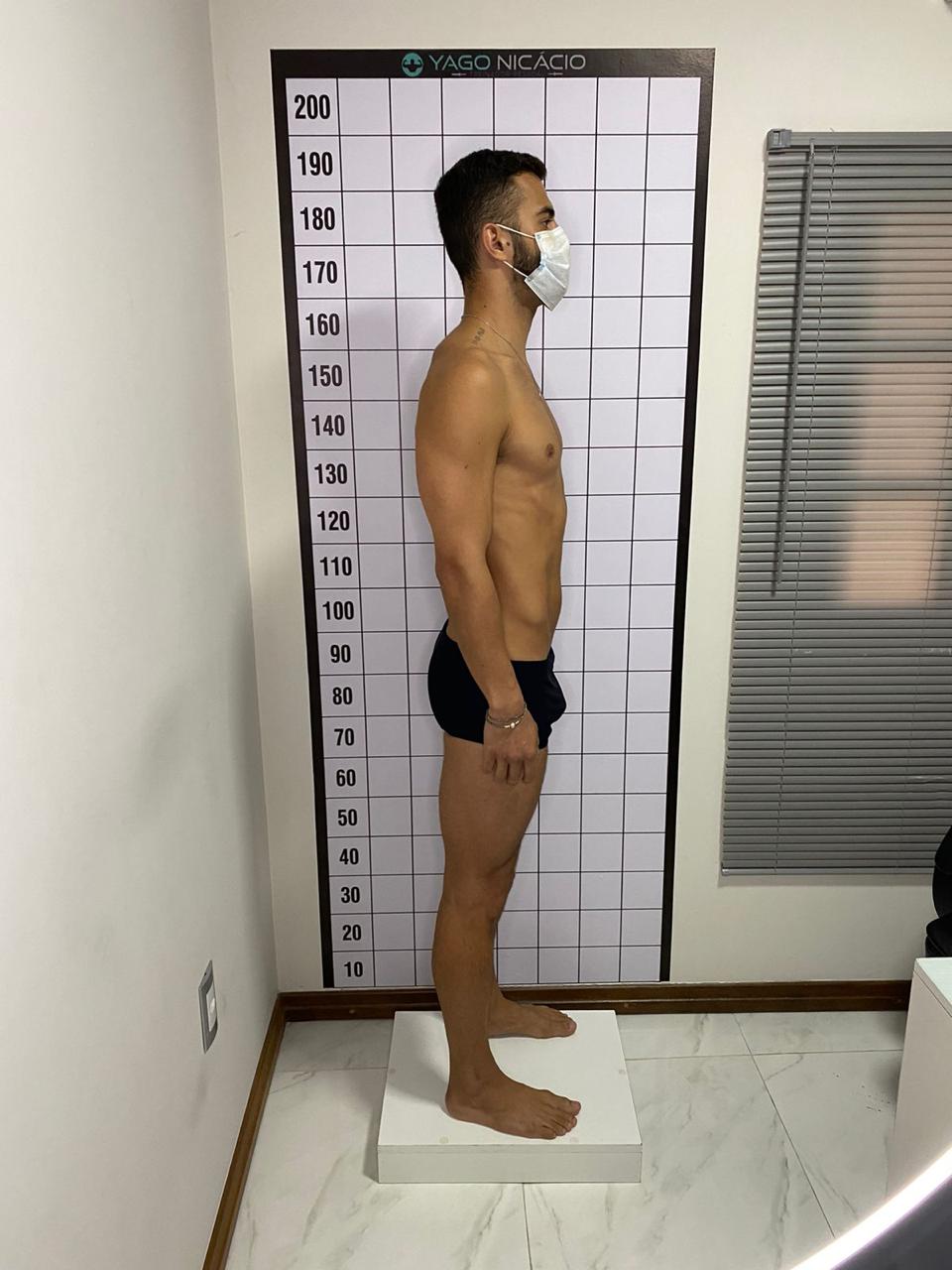 Depois - 1